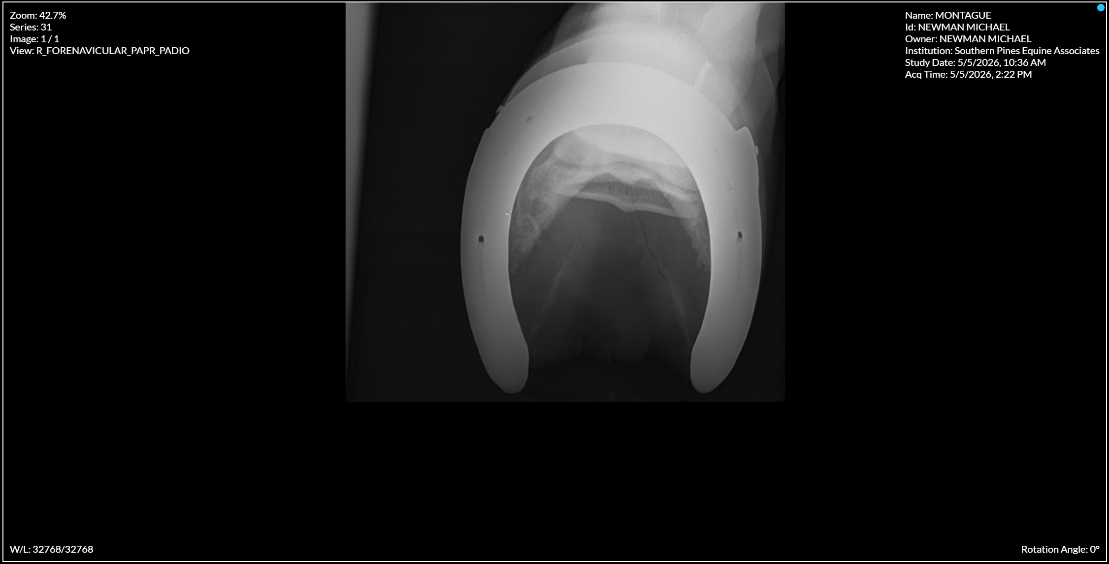 Right Forenavicular PAPR PADIO